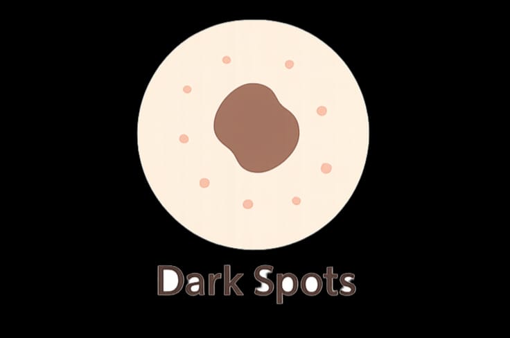 Dark Spots